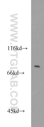 BBS10 Antibody in Western Blot (WB)