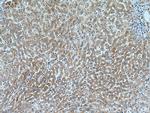 SLC20A1 Antibody in Immunohistochemistry (Paraffin) (IHC (P))