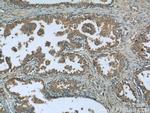 MAGEH1 Antibody in Immunohistochemistry (Paraffin) (IHC (P))