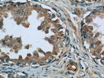 MAGEH1 Antibody in Immunohistochemistry (Paraffin) (IHC (P))