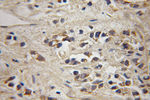 MAGEH1 Antibody in Immunohistochemistry (Paraffin) (IHC (P))