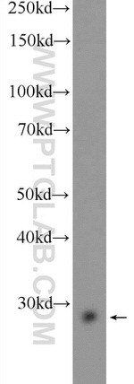 MAGEH1 Antibody in Western Blot (WB)