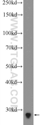 MAGEH1 Antibody in Western Blot (WB)