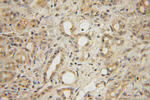 GLYCTK Antibody in Immunohistochemistry (Paraffin) (IHC (P))