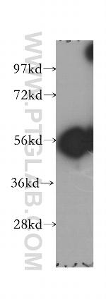GLYCTK Antibody in Western Blot (WB)