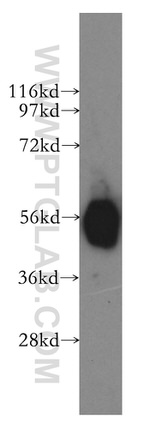 GLYCTK Antibody in Western Blot (WB)