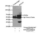 RNGTT Antibody in Immunoprecipitation (IP)
