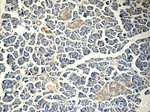 HOMER1 Antibody in Immunohistochemistry (Paraffin) (IHC (P))