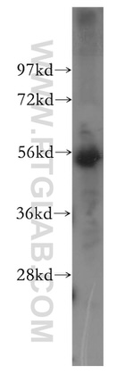 CREST Antibody in Western Blot (WB)