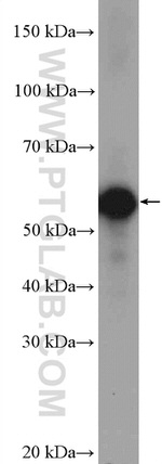 CREST Antibody in Western Blot (WB)
