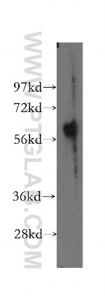 ESAM Antibody in Western Blot (WB)