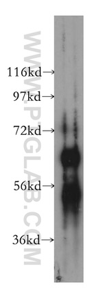 ESAM Antibody in Western Blot (WB)