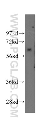 TBX6 Antibody in Western Blot (WB)