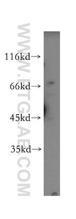 RPA1 Antibody in Western Blot (WB)