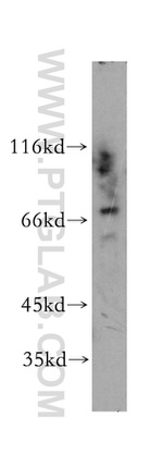 RPA1 Antibody in Western Blot (WB)
