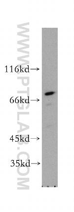 RPA1 Antibody in Western Blot (WB)
