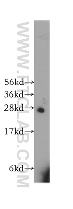 HS2ST1 Antibody in Western Blot (WB)