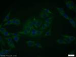 EPS8 Antibody in Immunocytochemistry (ICC/IF)