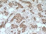 EPS8 Antibody in Immunohistochemistry (Paraffin) (IHC (P))