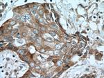 EPS8 Antibody in Immunohistochemistry (Paraffin) (IHC (P))