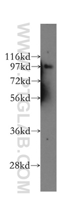EPS8 Antibody in Western Blot (WB)