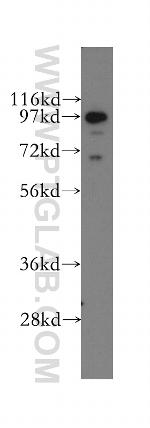 EPS8 Antibody in Western Blot (WB)
