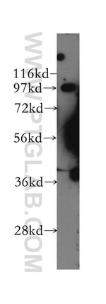 EPS8 Antibody in Western Blot (WB)