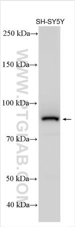 HOOK2 Antibody in Western Blot (WB)