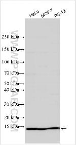 PPP1R1A Antibody in Western Blot (WB)
