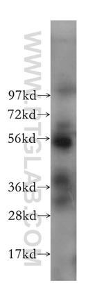 SPAG6 Antibody in Western Blot (WB)