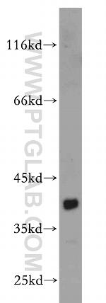 CDCA8 Antibody in Western Blot (WB)