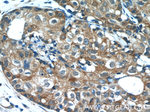 PANK1/2/3 Antibody in Immunohistochemistry (Paraffin) (IHC (P))