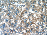 PANK1/2/3 Antibody in Immunohistochemistry (Paraffin) (IHC (P))