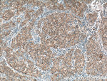PANK1/2/3 Antibody in Immunohistochemistry (Paraffin) (IHC (P))