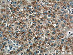 PANK1/2/3 Antibody in Immunohistochemistry (Paraffin) (IHC (P))