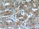 PANK1/2/3 Antibody in Immunohistochemistry (Paraffin) (IHC (P))