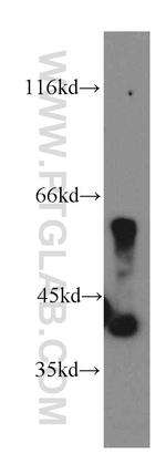 PANK1/2/3 Antibody in Western Blot (WB)
