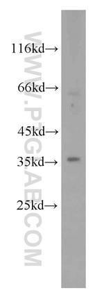 RHBDL2 Antibody in Western Blot (WB)