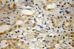 RECQL5 Antibody in Immunohistochemistry (Paraffin) (IHC (P))