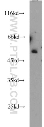 RECQL5 Antibody in Western Blot (WB)