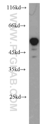 RECQL5 Antibody in Western Blot (WB)