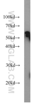 RECQL5 Antibody in Western Blot (WB)