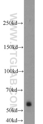 RECQL5 Antibody in Western Blot (WB)