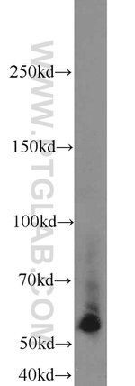RECQL5 Antibody in Western Blot (WB)