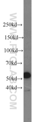 RECQL5 Antibody in Western Blot (WB)