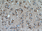 PIP4K2A Antibody in Immunohistochemistry (Paraffin) (IHC (P))
