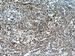 PIP4K2A Antibody in Immunohistochemistry (Paraffin) (IHC (P))