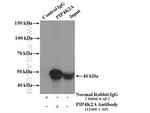 PIP4K2A Antibody in Immunoprecipitation (IP)