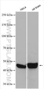PIP4K2A Antibody in Western Blot (WB)