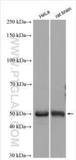 PIP4K2A Antibody in Western Blot (WB)